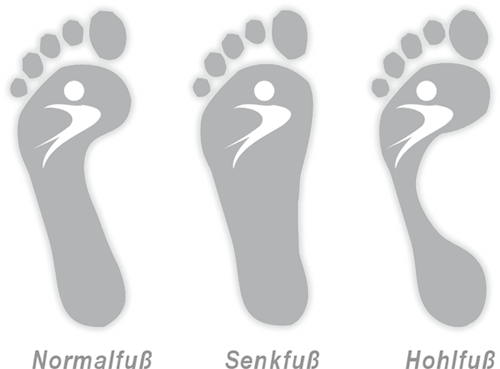Joggen - Fußformen: Normalfuß, Senkfuß, Hohlfuß